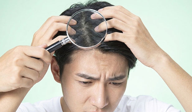 男性の髪に虫眼鏡を当てている写真